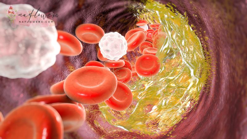 LDL Cholesterol คืออะไร?